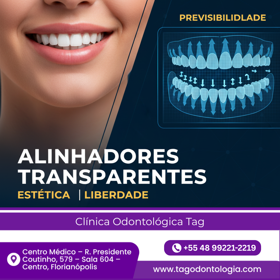 Alinhadores Transparentes