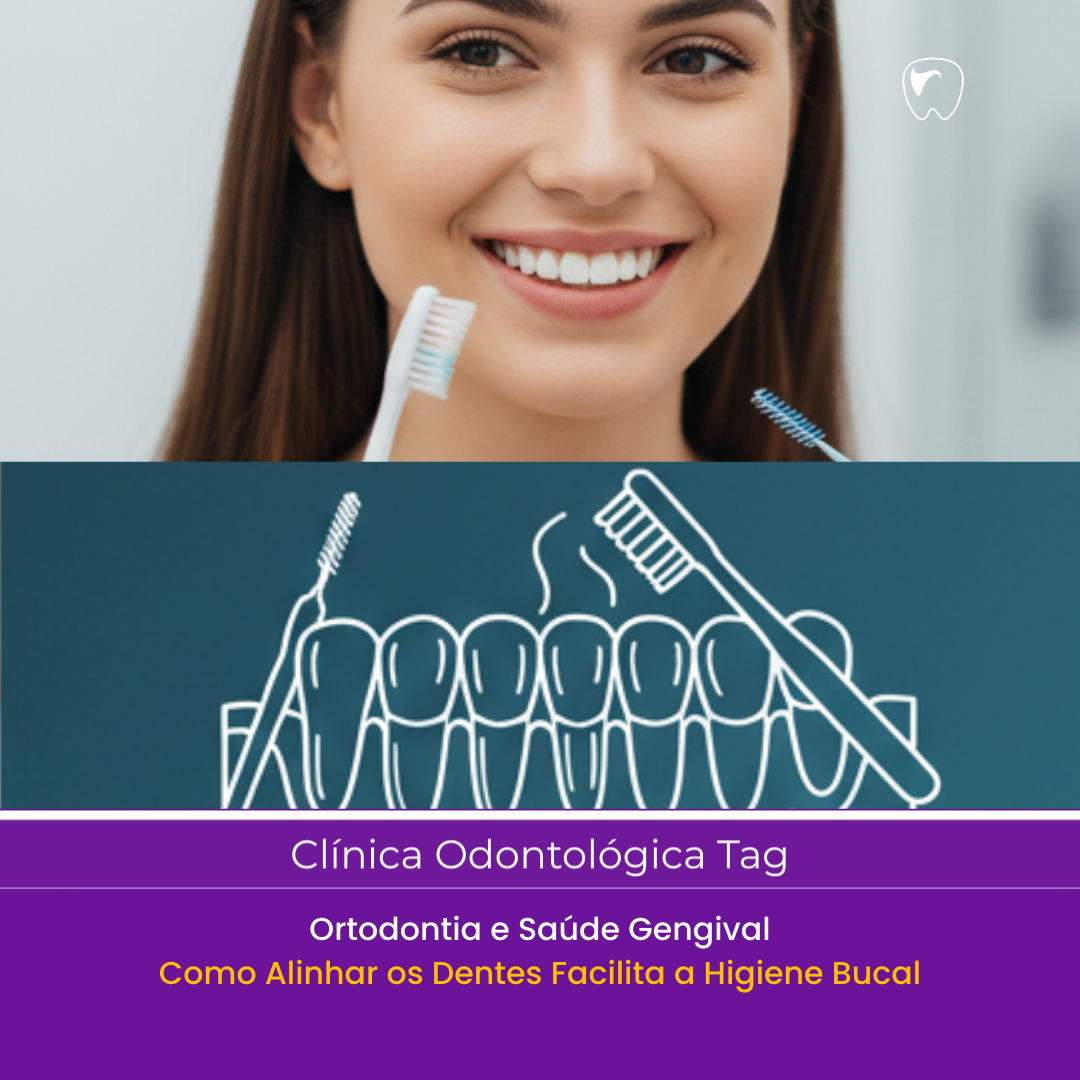Ortodontia e Saúde Gengival: Como Alinhar os Dentes Facilita a Higiene Bucal