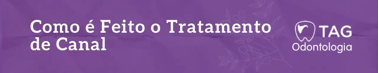 como-é-feito-o-tratamento-de-canal