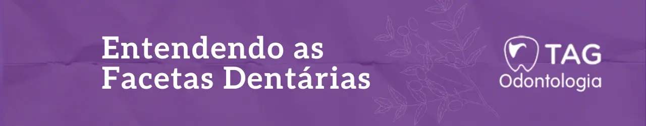 entendendo-as-facetas-dentárias