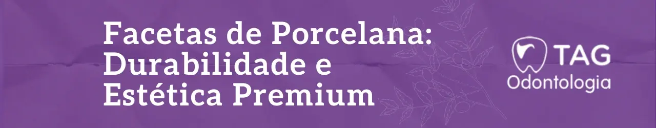 facetas-de-porcelana-1