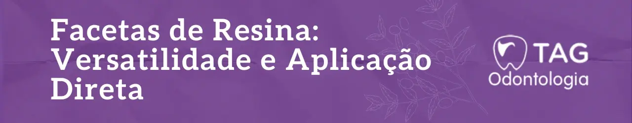 facetas-de-resina