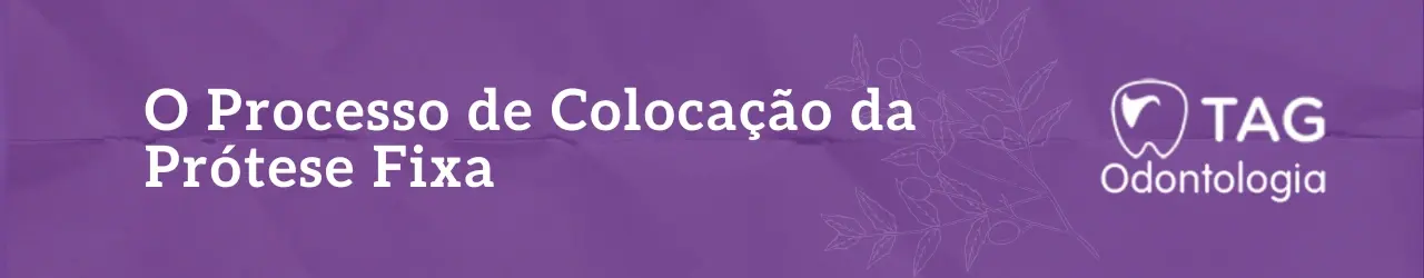 O Processo de Colocação da Prótese Fixa