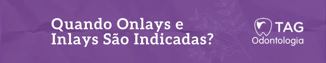 Quando Onlays e Inlays São Indicadas