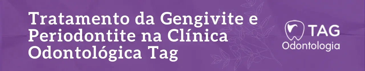 tratamento-da-gengivite-e-periodontite