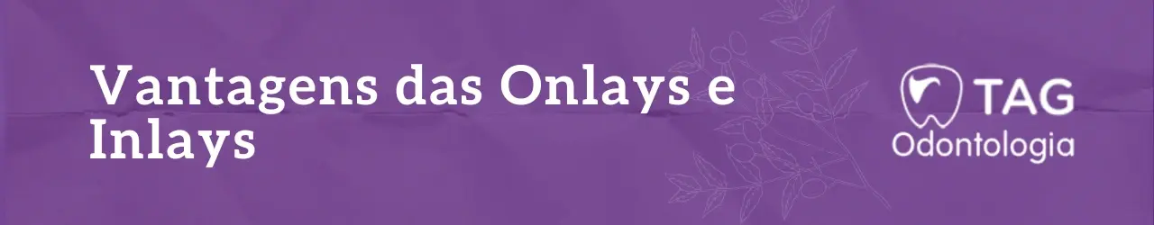 Vantagens das Onlays e Inlays