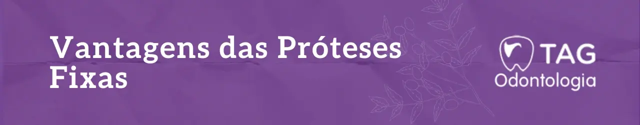 Vantagens das Próteses Fixas