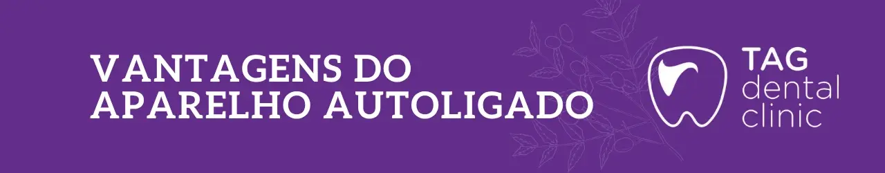 vantagens-do-aparelho-autoligado