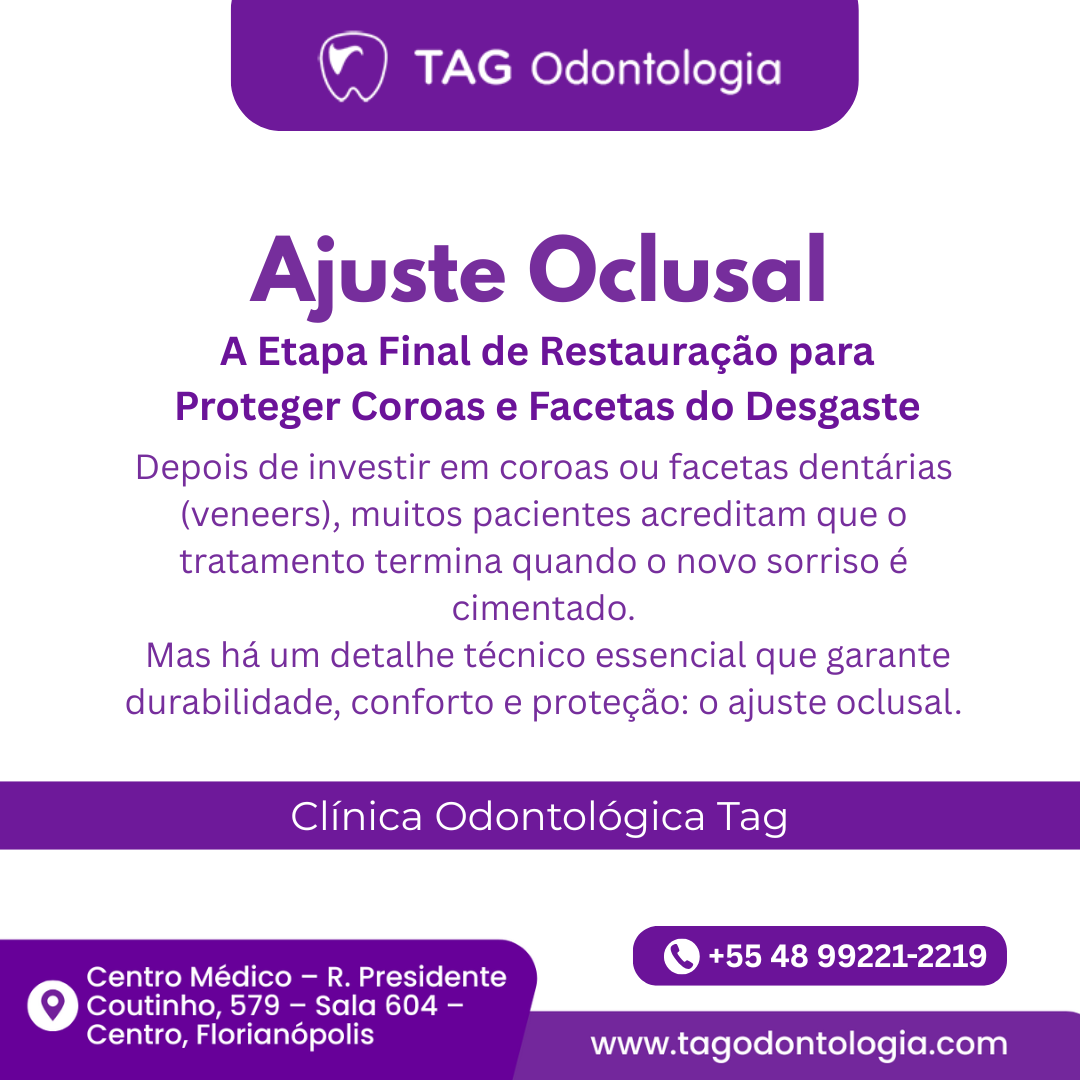 Ajuste Oclusal