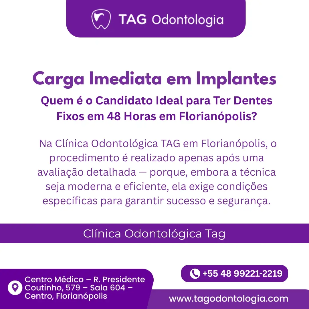 Carga Imediata em Implantes