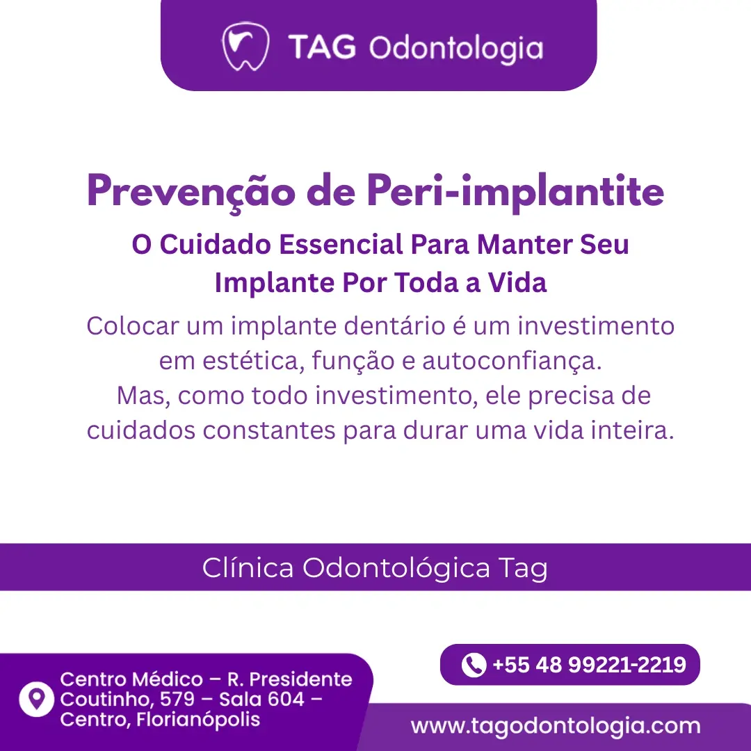 Prevenção de Peri-implantite