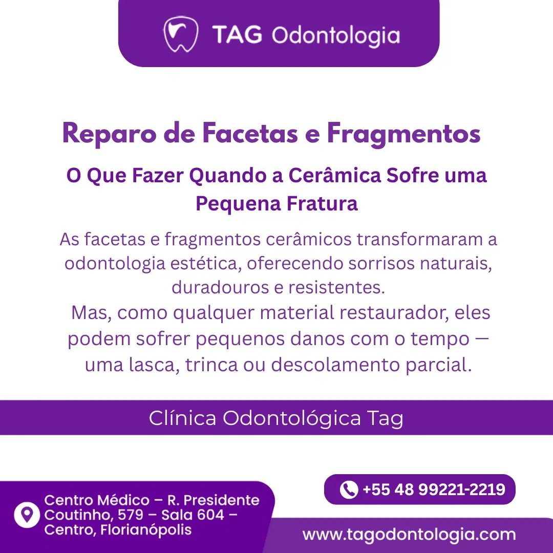 Reparo de Facetas e Fragmentos