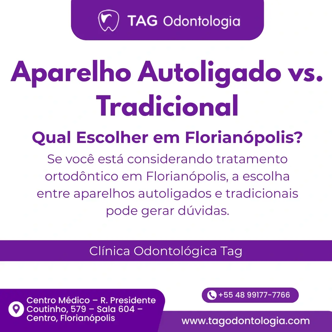 Aparelho Autoligado vs. Tradicional: Qual Escolher em Florianópolis?