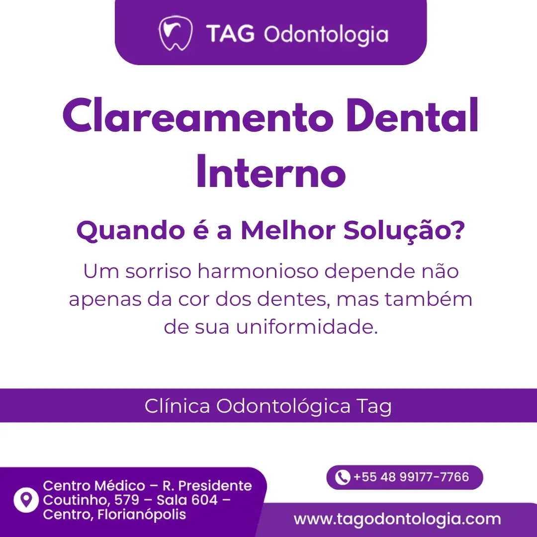 Clareamento Dental Interno: Quando é a Melhor Solução?