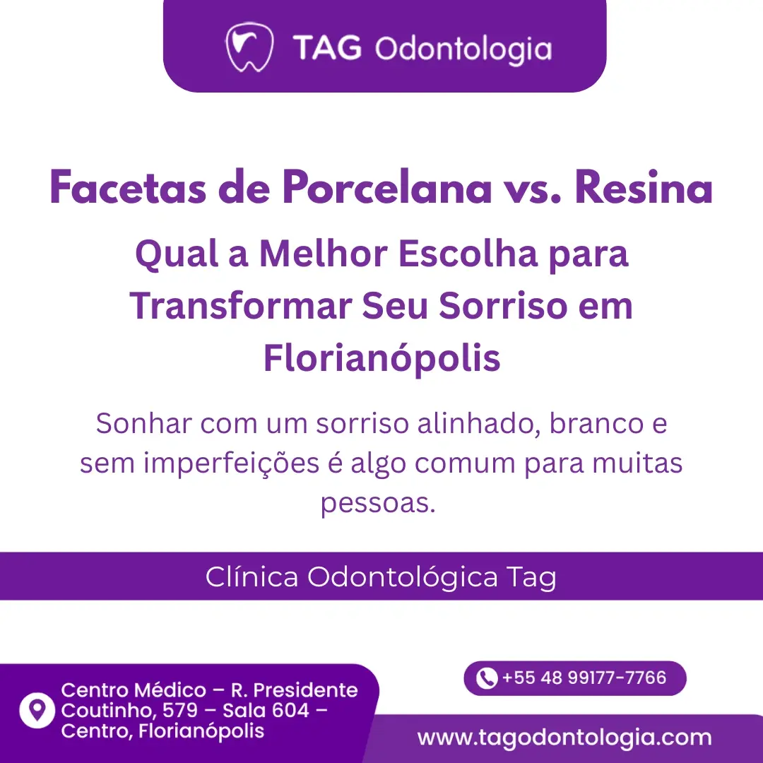 Facetas de Porcelana vs. Resina