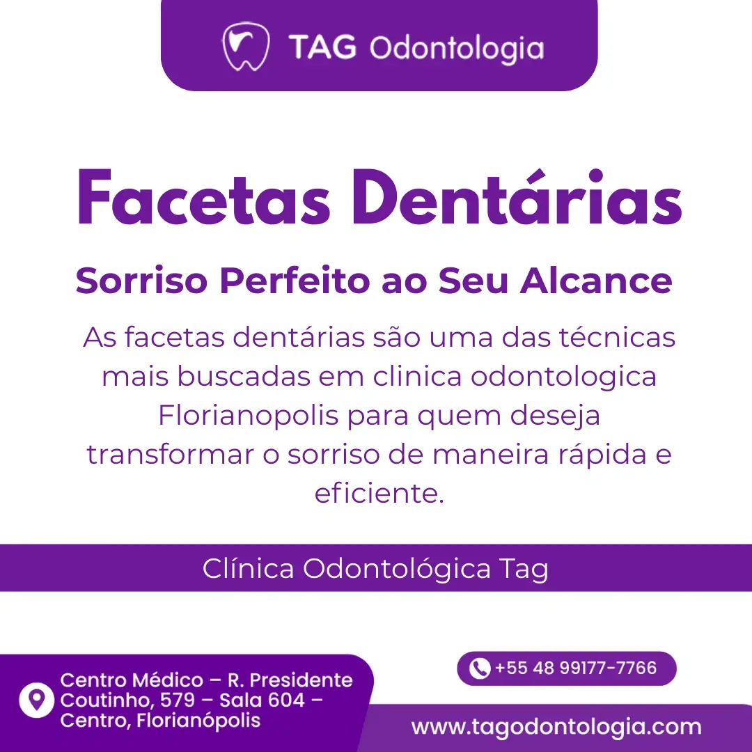 Facetas Dentárias em Florianópolis: Sorriso Perfeito ao Seu Alcance