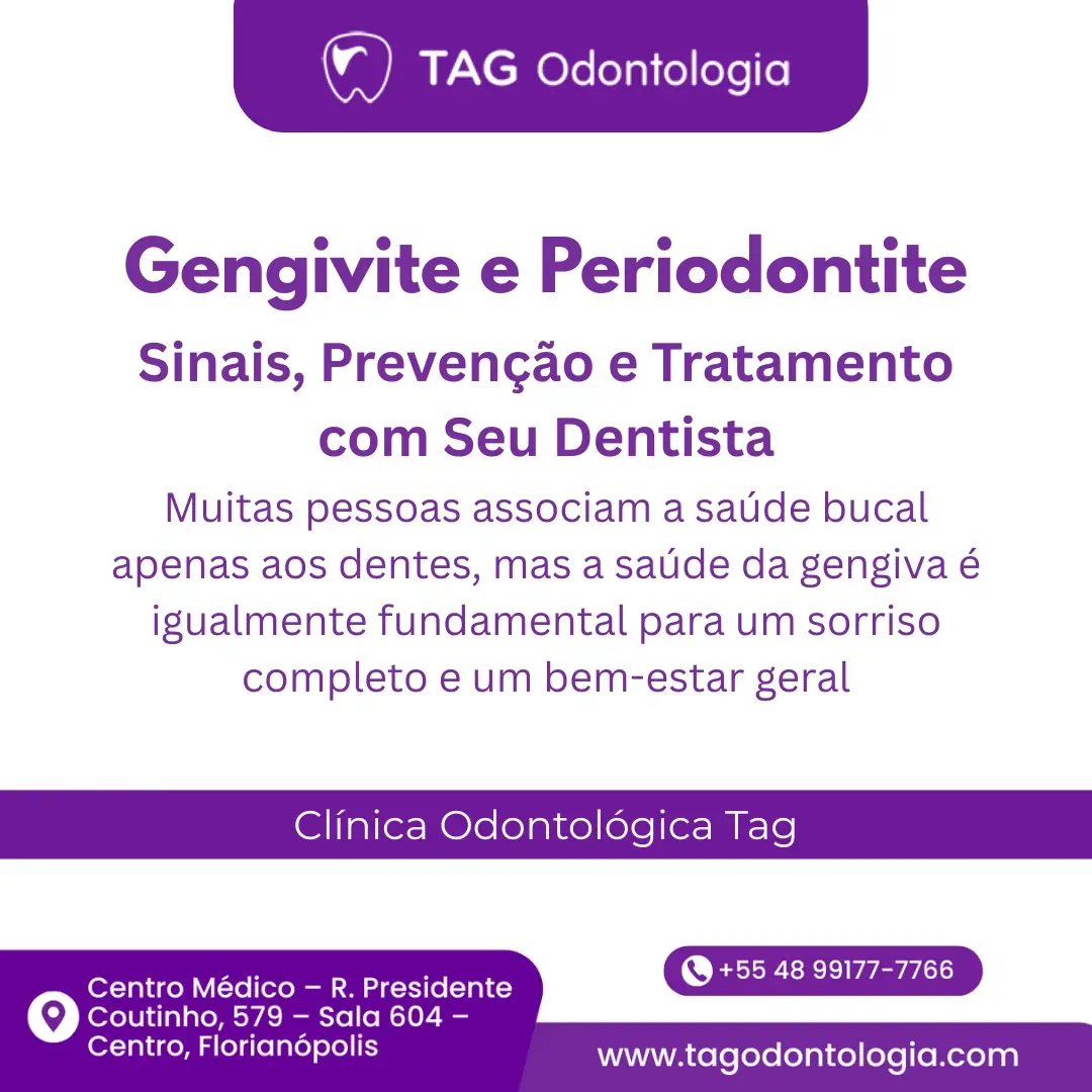 Gengivite e Periodontite