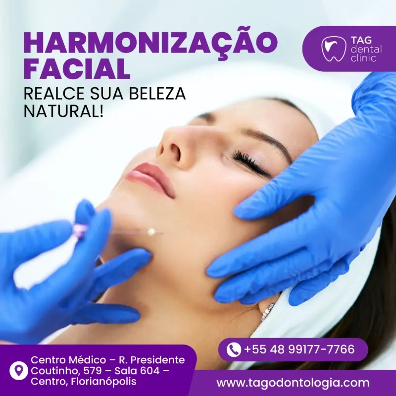 Harmonização Facial em Florianópolis by TAG