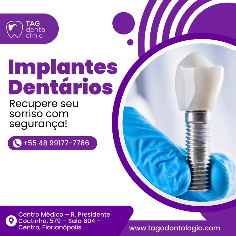 Implantes Dentários em Florianópolis