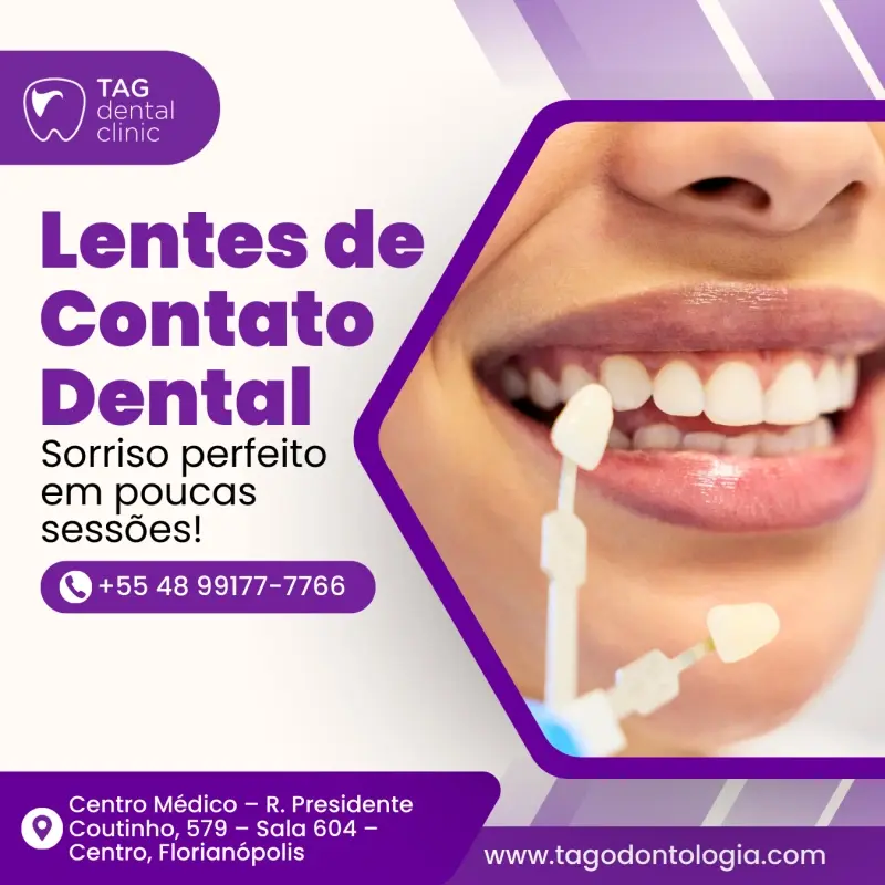 Lentes de Contato Dental em Florianópolis