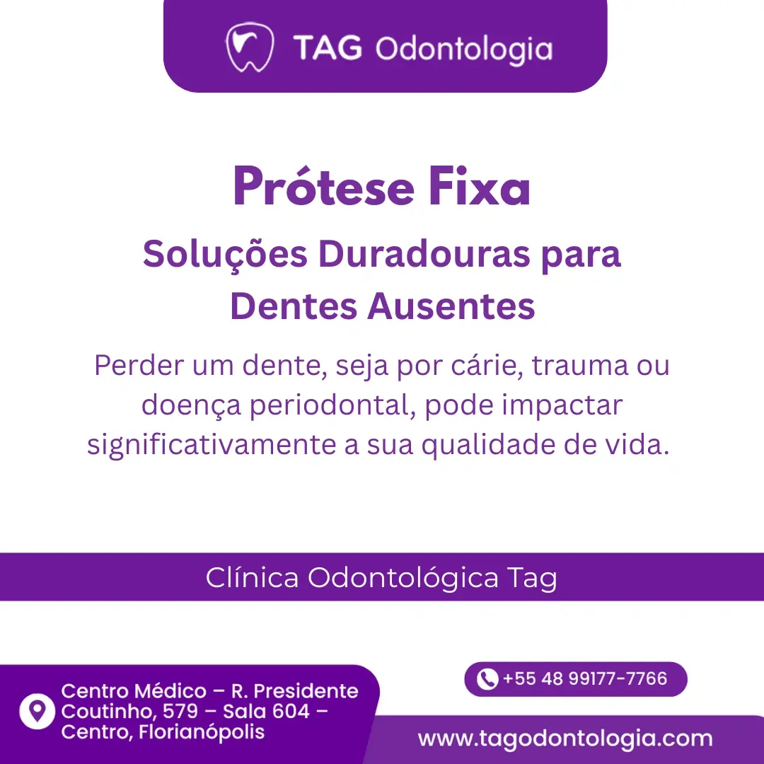 Prótese Fixa (Coroa e Ponte Fixa)
