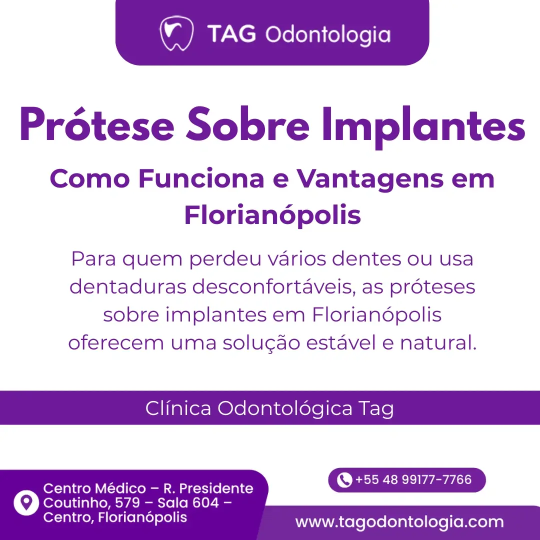 Prótese sobre Implantes: Como Funciona e Vantagens em Florianópolis